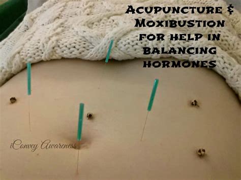 Acupuncture therapy mamas bee magic